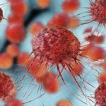 141030210436 cancer 624x351 thinkstock